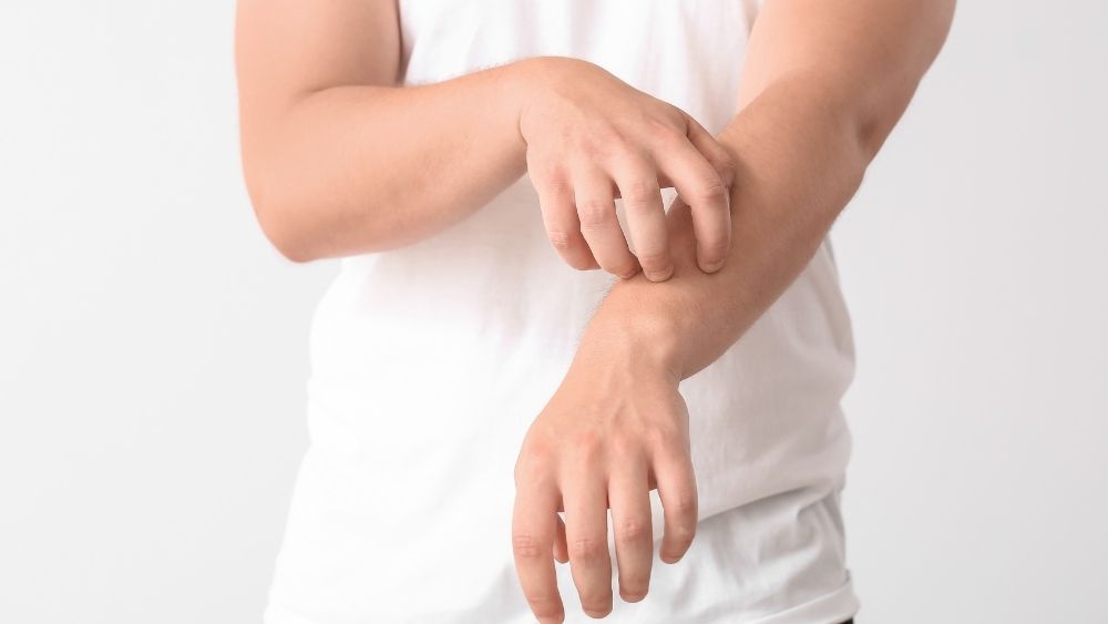 Eczema and Dermatitis