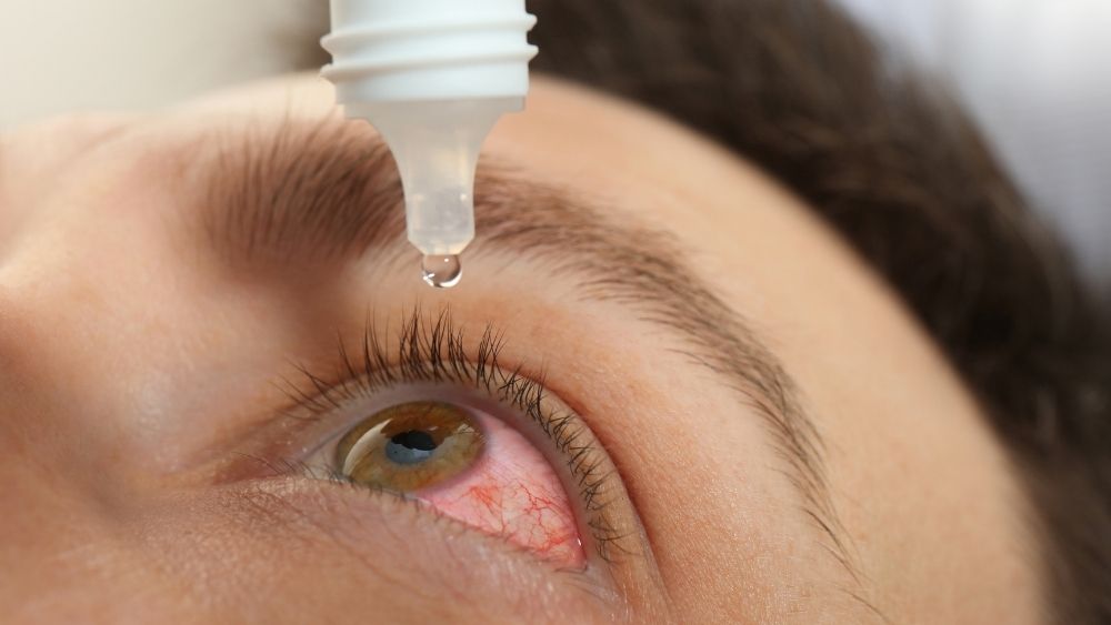 Eye Infections