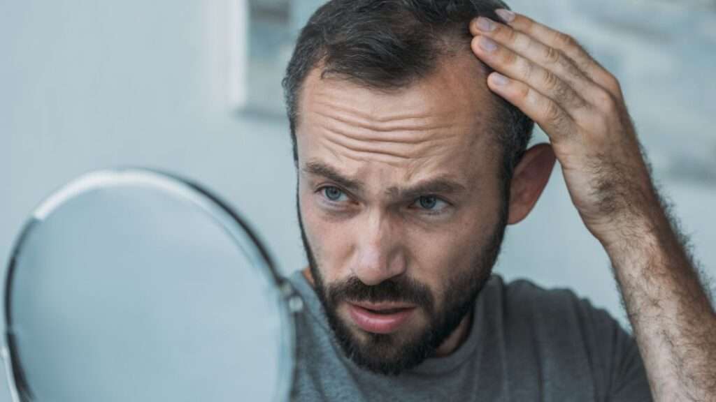 Man looking in a mirror to display hair loss treatments