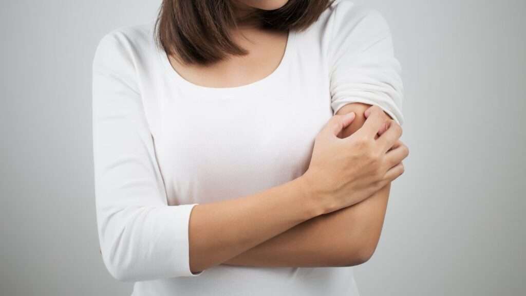 Woman itching mosquito bite to represent malaria risk